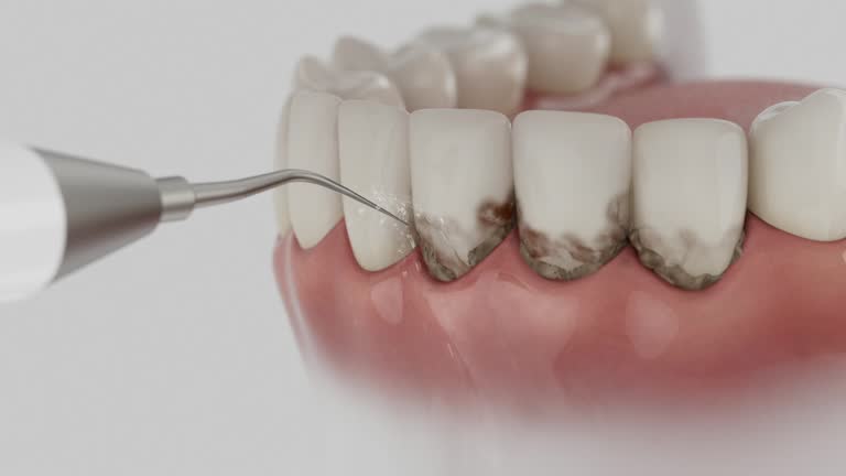 Trusted Tooth Extraction service in Chatsworth, GA - Dentist Open Now
